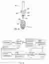 Fig. 36 - Methods and devices for intracorporeal bonding of implants with thermal energy