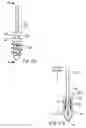 Fig. 37 - Methods and devices for intracorporeal bonding of implants with thermal energy