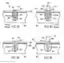 Fig. 40 - Methods and devices for intracorporeal bonding of implants with thermal energy