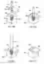 Fig. 41 - Methods and devices for intracorporeal bonding of implants with thermal energy