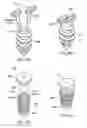 Fig. 44 - Methods and devices for intracorporeal bonding of implants with thermal energy
