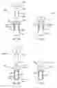 Fig. 48 - Methods and devices for intracorporeal bonding of implants with thermal energy