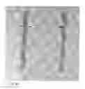 Fig. 55 - Methods and devices for intracorporeal bonding of implants with thermal energy