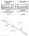 Fig. 73 - Methods and devices for intracorporeal bonding of implants with thermal energy