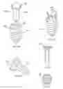 Fig. 84 - Methods and devices for intracorporeal bonding of implants with thermal energy