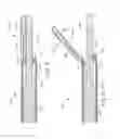 Fig. 04 - Surgical instrument with staged application of electrosurgical and ultrasonic energy