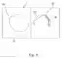 Fig. 08 - Ablation system with automated sweeping ablation energy element