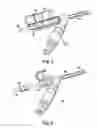 Fig. 08 - Multi-functional catheter