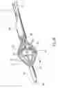 Fig. 04 - DEVICES, SYSTEMS AND METHODS FOR TREATING TISSUE REGIONS OF THE BODY