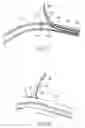 Fig. 13 - DEVICES, SYSTEMS AND METHODS FOR TREATING TISSUE REGIONS OF THE BODY
