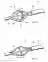 Fig. 34 - DEVICES, SYSTEMS AND METHODS FOR TREATING TISSUE REGIONS OF THE BODY