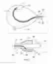 Fig. 03 - Method of surgical perforation via the delivery of energy