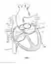 Fig. 14 - Method of surgical perforation via the delivery of energy