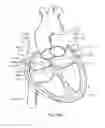 Fig. 16 - Method of surgical perforation via the delivery of energy