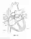 Fig. 23 - Method of surgical perforation via the delivery of energy