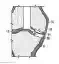 Fig. 01 - Implant planning using captured joint motion information