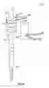 Fig. 08 - Actuated cannula seal