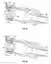 Fig. 11 - Actuated cannula seal
