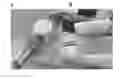 Fig. 01 - Self-contained lighting device and lighted suction device