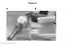 Fig. 06 - Self-contained lighting device and lighted suction device