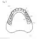 Fig. 02 - ARTIFICIAL TOOTH