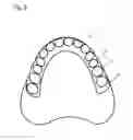 Fig. 04 - ARTIFICIAL TOOTH
