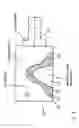 Fig. 04 - Method for producing a dental restoration