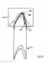 Fig. 08 - Method for producing a dental restoration