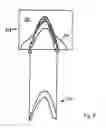 Fig. 09 - Method for producing a dental restoration