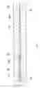 Fig. 06 - Method for manufacturing an interdental cleaning tool and the interdental cleaning tool
