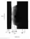 Fig. 11 - Method for manufacturing an interdental cleaning tool and the interdental cleaning tool