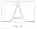 Fig. 07 - ULTRASONIC TOOTH CLEANING APPARATUS AND METHOD