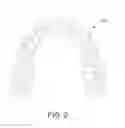 Fig. 03 - Mouth Appliance Devices, Systems, and Methods