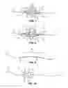 Fig. 04 - Structural support incorporating multiple strands