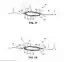 Fig. 05 - Structural support incorporating multiple strands