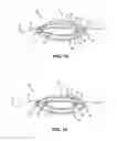 Fig. 07 - Structural support incorporating multiple strands