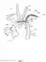 Fig. 02 - Embolic protection device and method