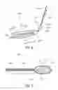 Fig. 03 - Embolic protection device and method