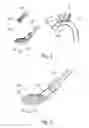 Fig. 04 - Embolic protection device and method