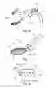 Fig. 05 - Embolic protection device and method
