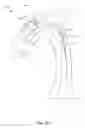 Fig. 13 - Embolic protection device and method