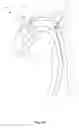 Fig. 14 - Embolic protection device and method