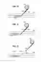Fig. 06 - INFUSION FILTER AND METHOD FOR PERFORMING THROMBOLYSIS