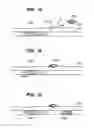 Fig. 07 - INFUSION FILTER AND METHOD FOR PERFORMING THROMBOLYSIS