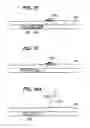 Fig. 08 - INFUSION FILTER AND METHOD FOR PERFORMING THROMBOLYSIS
