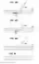 Fig. 09 - INFUSION FILTER AND METHOD FOR PERFORMING THROMBOLYSIS