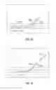 Fig. 13 - INFUSION FILTER AND METHOD FOR PERFORMING THROMBOLYSIS