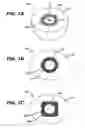 Fig. 02 - Injection zone markers for biomedical implants