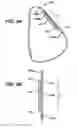 Fig. 06 - Injection zone markers for biomedical implants