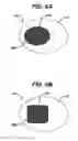 Fig. 07 - Injection zone markers for biomedical implants